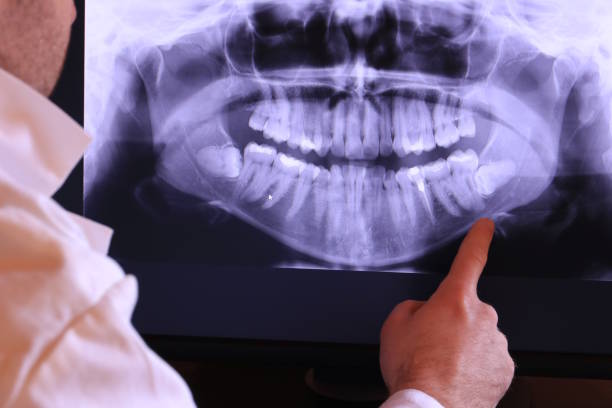Best Cracked Tooth Emergency Dentist  in Amherst, VA