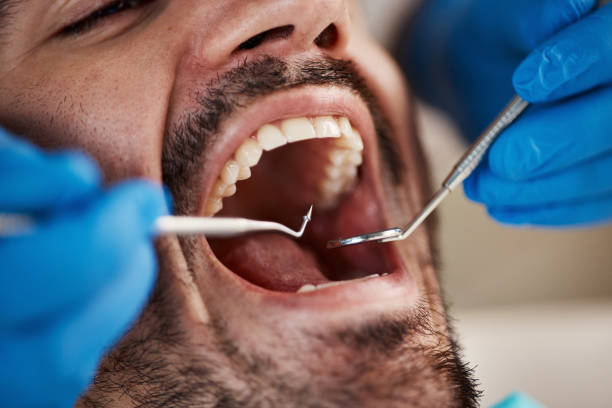 Best Emergency Tooth Extraction  in Amherst, VA